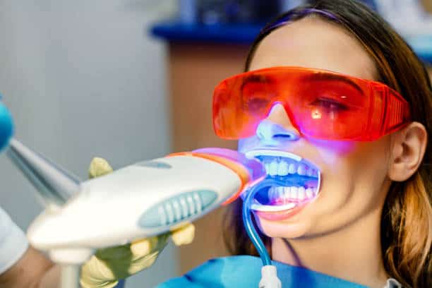 Simplifying Teeth Whitening: A Comprehensive Guide Milton Keynes