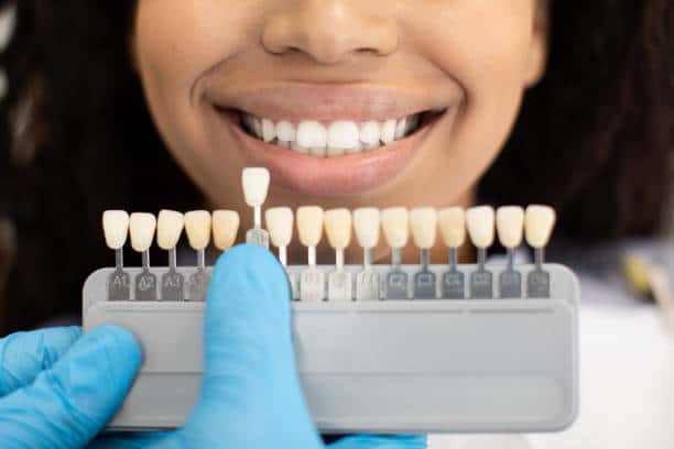 Laser Teeth Whitening: Exploring the Longevity of Your Brighter Smile Milton Keynes