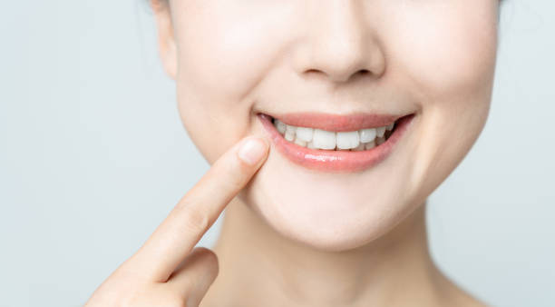 Comparing the Pain Factor: Laser Teeth Whitening vs. Zoom Teeth Whitening Milton Keynes