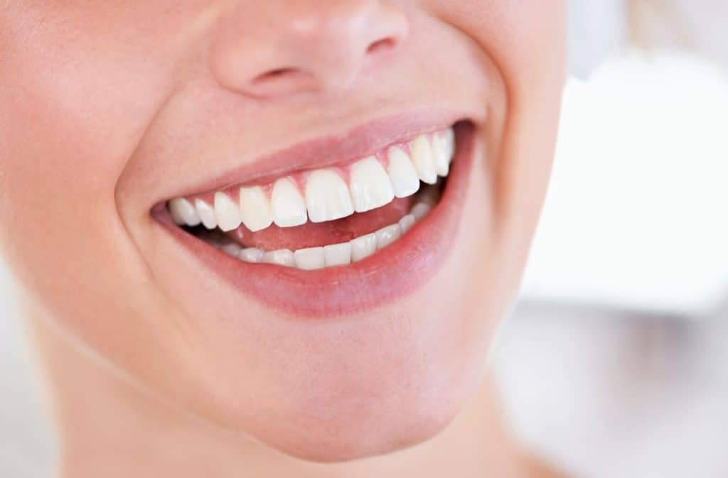 Teeth Whitening West Drayton Milton Keynes