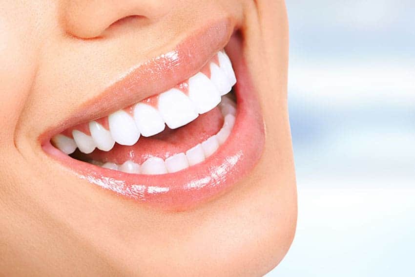 Teeth Whitening Abingdon Milton Keynes